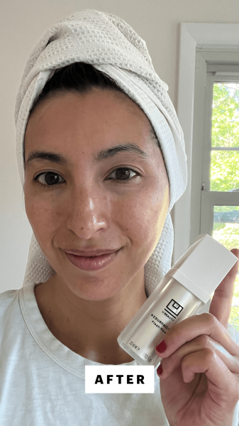 Pai after applying the U Beauty Resurfacing Flash Peel