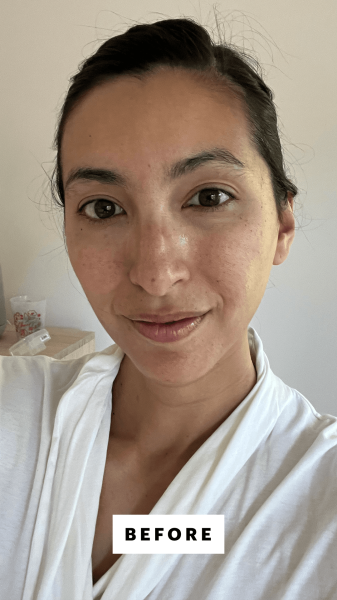 Pai before applying the U Beauty Resurfacing Flash Peel