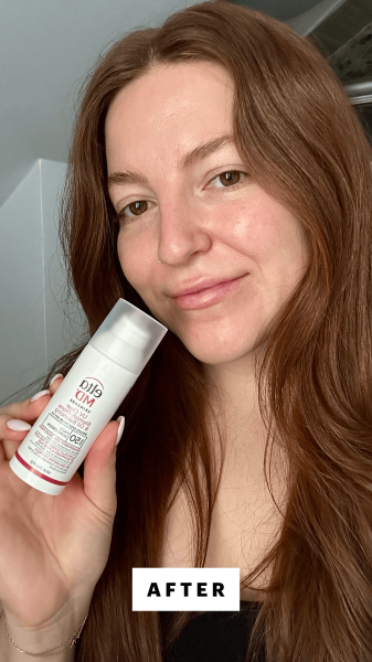 A selfie of Allure senior staff writer Elizabeth Gulino after applying the EltaMD UV Clear BlemishProne Oil Balancing...