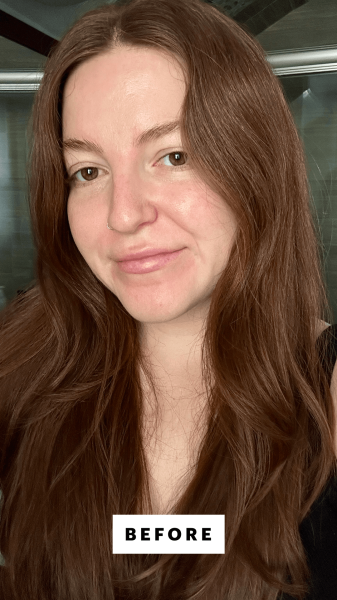 A selfie of Allure senior staff writer Elizabeth Gulino before applying the EltaMD UV Clear BlemishProne Oil Balancing...