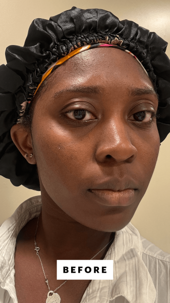 BlayTettey before using the BeautyStat Universal Triple Action Daily Peel