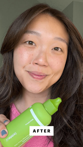 Lee after applying the Centellian 24 Madeca Matcha Peeling Gel